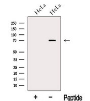 MEX3C Antibody - Western blot analysis of extracts of HeLa cells using MEX3C antibody. The lane on the left was treated with blocking peptide.