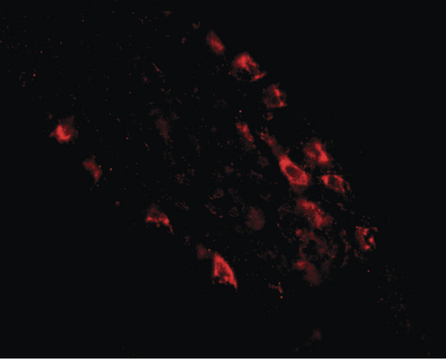 MEX3D Antibody - Immunofluorescence of rkhd1 in human small intestine tissue with rkhd1 antibody at 20 ug/ml.
