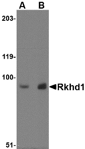 MEX3D Antibody - Western blot of Rkhd1 in MDA-MB-361 cell lysate with Rkhd1 antibody at (A) 1 ug/ml and (B) 2 ug/ml