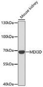 MEX3D Antibody - Western blot analysis of extracts of mouse kidney using MEX3D Polyclonal Antibody at dilution of 1:1000.