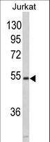 MFAP1 Antibody - Western blot of MFAP1 in Jurkat cell line lysates (35 ug/lane). MFAP1 (arrow) was detected using the purified antibody.