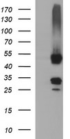 MFAP3 Antibody - HEK293T cells were transfected with the pCMV6-ENTRY control (Left lane) or pCMV6-ENTRY MFAP3 (Right lane) cDNA for 48 hrs and lysed. Equivalent amounts of cell lysates (5 ug per lane) were separated by SDS-PAGE and immunoblotted with anti-MFAP3.