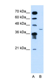 MFAP3L / NYD-Sp9 Antibody - MFAP3L antibody ARP44576_T100-NP_067679-MFAP3L(microfibrillar-associated protein 3-like) Antibody Western blot of Jurkat lysate.  This image was taken for the unconjugated form of this product. Other forms have not been tested.