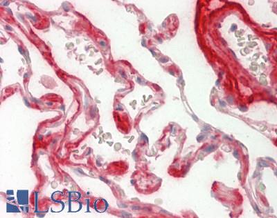 MFAP4 Antibody - Human Lung: Formalin-Fixed, Paraffin-Embedded (FFPE).  This image was taken for the unconjugated form of this product. Other forms have not been tested.