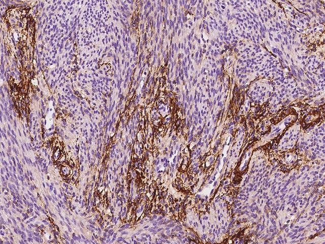 MFAP4 Antibody - Immunochemical staining of human MFAP4 in human corpus uteri with rabbit polyclonal antibody at 1:200 dilution, formalin-fixed paraffin embedded sections.