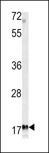 MFAP5 / MAGP2 Antibody - Western blot of MFAP5 antibody in K562 cell line lysates (35 ug/lane). MFAP5 (arrow) was detected using the purified antibody.