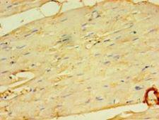 MFAP5 / MAGP2 Antibody - Immunohistochemistry of paraffin-embedded human skeletal muscle tissue using antibody at 1:100 dilution.  This image was taken for the unconjugated form of this product. Other forms have not been tested.