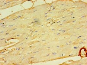 MFAP5 / MAGP2 Antibody - Immunohistochemistry of paraffin-embedded human skeletal muscle tissue using antibody at 1:100 dilution.  This image was taken for the unconjugated form of this product. Other forms have not been tested.