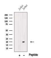 MFAP5 / MAGP2 Antibody - Western blot analysis of extracts of Jurkat cells using MFAP5 antibody. The lane on the left was treated with blocking peptide.