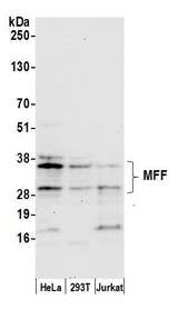 MFF Antibody - Detection of human MFF by western blot. Samples: Whole cell lysate (50 µg) from HeLa, HEK293T, and Jurkat (50µg) cells prepared using NETN lysis buffer. Antibody: Affinity purified rabbit anti-MFF antibody used for WB at 1:1000. Detection: Chemiluminescence with an exposure time of 30 seconds.