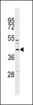 MFF Antibody - MFF Antibody western blot of NCI-H460 cell line lysates (35 ug/lane). The MFF antibody detected the MFF protein (arrow).