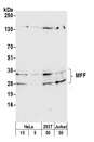 MFF Antibody - Detection of human and mouse MFF by western blot. Samples: Whole cell lysate from HeLa (5 and 15 µg) 293T, (50µg), and Jurkat (50µg) cells prepared using NETN lysis buffer. Antibody: Affinity purified rabbit anti-MFF antibody used for WB at 1:1000. Detection: Chemiluminescence with an exposure time of 30 seconds.