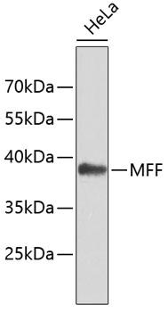 MFF Antibody - Western blot analysis of extracts of HeLa cells using MFF Polyclonal Antibody.