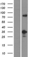 MFF Protein - Western validation with an anti-DDK antibody * L: Control HEK293 lysate R: Over-expression lysate