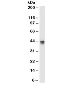 MFGE8 /Lactadherin Antibody - Western blot testing of MCF7 cell lysate with Lactadherin antibody (clone EDM45). This image was taken for the unmodified form of this product. Other forms have not been tested.