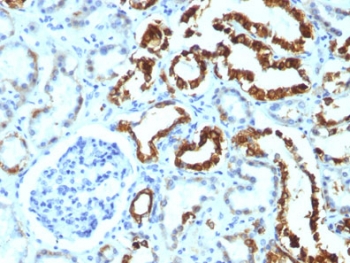 MFGE8 /Lactadherin Antibody - FFPE human renal cell carcinoma tested with MFGE8 antibody (MFG-06).  This image was taken for the unmodified form of this product. Other forms have not been tested.