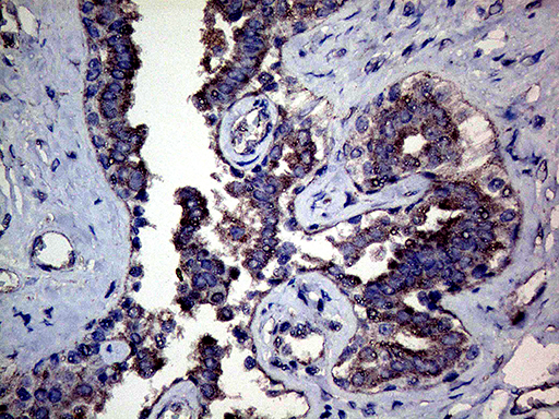 MFGE8 /Lactadherin Antibody - Immunohistochemical staining of paraffin-embedded Human breast tissue within the normal limits using anti-MFGE8 mouse monoclonal antibody. (Heat-induced epitope retrieval by 1mM EDTA in 10mM Tris buffer. (pH8.5) at 120°C for 3 min. (1:500)