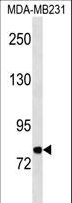 MFI2 / p97 Antibody - MFI2 Antibody western blot of MDA-MB231 cell line lysates (35 ug/lane). The MFI2 antibody detected the MFI2 protein (arrow).