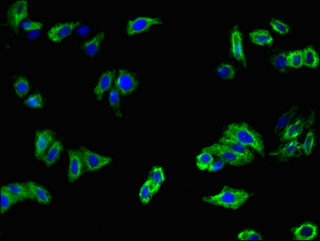MFI2 / p97 Antibody - Immunofluorescent analysis of HepG2 cells using MELTF Antibody at dilution of 1:100 and Alexa Fluor 488-congugated AffiniPure Goat Anti-Rabbit IgG(H+L)