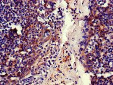 MFI2 / p97 Antibody - Immunohistochemistry of paraffin-embedded human tonsil tissue using MELTF Antibody at dilution of 1:100