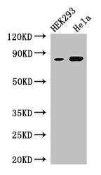 MFI2 / p97 Antibody - Western Blot Positive WB detected in: HEK293 whole cell lysate, Hela whole cell lysate All lanes: Mfi2 antibody at 3µg/ml Secondary Goat polyclonal to rabbit IgG at 1/50000 dilution Predicted band size: 81, 33 kDa Observed band size: 81 kDa