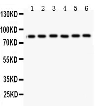 MFN1 Antibody - Mitofusin 1 antibody Western blot. All lanes: Anti Mitofusin 1 at 0.5 ug/ml. Lane 1: Rat Cardiac Muscle Tissue Lysate at 50 ug. Lane 2: Rat Kidney Tissue Lysate at 50 ug. Lane 3: Mouset Cardiac Muscle Tissue Lysate at 50 ug. Lane 4: HELA Whole Cell Lysate at 40 ug. Lane 5: COLO320 Whole Cell Lysate at 40 ug. Lane 6: A549 Whole Cell Lysate at 40 ug. Predicted band size: 84 kD. Observed band size: 84 kD.