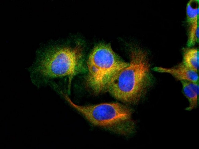 MFN1 Antibody - Immunocytochemistry/Immunofluorescence: Mitofusin-1 Antibody - Mitofusin-1 antibody was tested in HepG2 cells with Dylight 488 (green). Nuclei and alpha-tubulin were counterstained with DAPI (blue) and Dylight 550 (red).  This image was taken for the unconjugated form of this product. Other forms have not been tested.