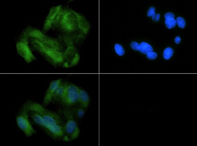 MFN1 Antibody - Immunocytochemistry/Immunofluorescence: Mitofusin-1 Antibody - MITO1 antibody was tested at 1:100 in HepG2 cells with FITC (green). Nuclei (Blue) were counterstained with Dapi (blue).  This image was taken for the unconjugated form of this product. Other forms have not been tested.