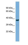 MFN1 Antibody - MFN1 antibody Western Blot of Fetal Muscle. Antibody dilution: 1 ug/ml.  This image was taken for the unconjugated form of this product. Other forms have not been tested.