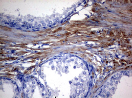 MFN1 Antibody - IHC of paraffin-embedded Human prostate tissue using anti-MFN1 mouse monoclonal antibody.