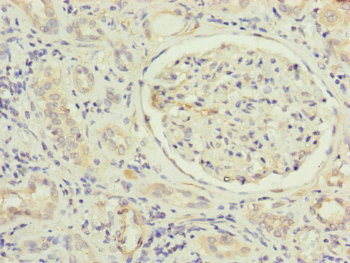 MFN1 Antibody - Immunohistochemistry of paraffin-embedded human kidney tissue at dilution of 1:100
