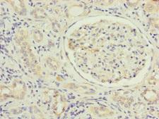 MFN1 Antibody - Immunohistochemistry of paraffin-embedded human kidney tissue at dilution of 1:100