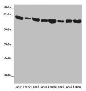 MFN1 Antibody - Western blot All Lanes:MFN1 antibody at 3.78 ug/ml Lane 1: Human placenta tissue Lane 2: Mouse kidney tissue Lane 3: NIH/3T3 whole cell lysate Lane 4: A431 whole cell lysate Lane 5: Jurkat whole cell lysate Lane 6: Hela whole cell lysate Lane 7: PC-3 whole cell lysate Lane 8: K562 whole cell lysate Secondary Goat polyclonal to rabbit IgG at 1/10000 dilution Predicted band size: 85,42,72 kDa Observed band size: 84 kDa