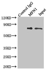 MFN1 Antibody - Immunoprecipitating MFN1 in Jurkat whole cell lysate Lane 1: Rabbit monoclonal IgG(1ug)instead of product in Jurkat whole cell lysate.For western blotting, a HRP-conjugated light chain specific antibody was used as the Secondary antibody (1/50000) Lane 2: product(4ug)+ Jurkat whole cell lysate(500ug) Lane 3: Jurkat whole cell lysate (20ug)