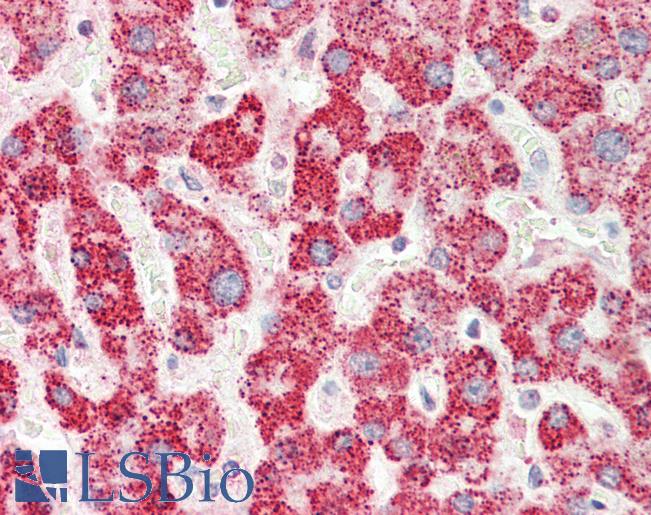 MFNG / Manic Fringe Antibody - Anti-MFNG / Manic Fringe antibody IHC staining of human liver. Immunohistochemistry of formalin-fixed, paraffin-embedded tissue after heat-induced antigen retrieval. Antibody concentration 5 ug/ml.  This image was taken for the unconjugated form of this product. Other forms have not been tested.
