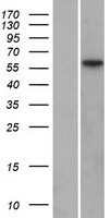 MFRP Protein - Western validation with an anti-DDK antibody * L: Control HEK293 lysate R: Over-expression lysate