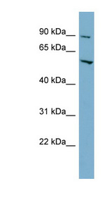 MFSD1 Antibody - MFSD1 antibody Western blot of HT1080 cell lysate. This image was taken for the unconjugated form of this product. Other forms have not been tested.