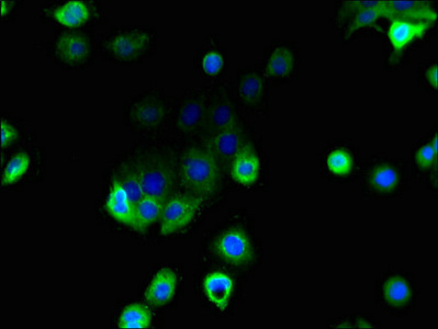 MFSD1 Antibody - Immunofluorescent analysis of A431 cells using MFSD1 Antibody at dilution of 1:100 and Alexa Fluor 488-congugated AffiniPure Goat Anti-Rabbit IgG(H+L)