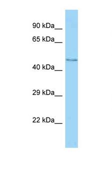 MFSD11 / ET Antibody - MFSD11 antibody Western blot of Mouse Thymus lysate. Antibody concentration 1 ug/ml.  This image was taken for the unconjugated form of this product. Other forms have not been tested.