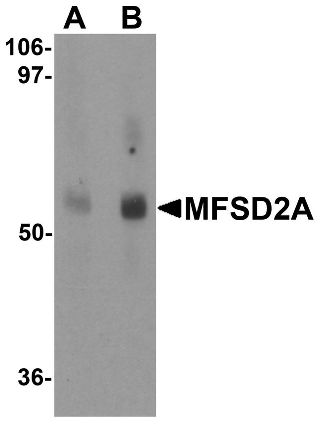 MFSD2A Antibody - Western blot analysis of MFSD2A in rat lung tissue lysate with MFSD2A antibody at (A) 1 and (B) 2 ug/ml.