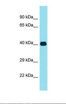 MFSD2A Antibody - Western blot of Human Thyroid Tumor. MFSD2A antibody dilution 1.0 ug/ml.  This image was taken for the unconjugated form of this product. Other forms have not been tested.