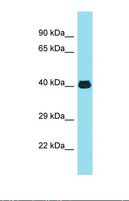 MFSD2A Antibody - Western blot of Human Thyroid Tumor. MFSD2A antibody dilution 1.0 ug/ml.  This image was taken for the unconjugated form of this product. Other forms have not been tested.