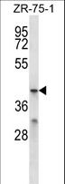 MFSD2B Antibody - MFSD2B Antibody western blot of ZR-75-1 cell line lysates (35 ug/lane). The MFSD2B antibody detected the MFSD2B protein (arrow).