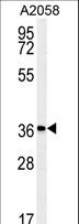 MFSD3 Antibody - Western blot of MFSD3 Antibody in A2058 cell line lysates (35 ug/lane). MFSD3 (arrow) was detected using the purified antibody.