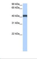 MFSD3 Antibody - MCF7 cell lysate. Antibody concentration: 0.5 ug/ml. Gel concentration: 12%.  This image was taken for the unconjugated form of this product. Other forms have not been tested.