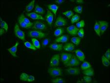 MFSD4 Antibody - Immunofluorescence staining of Hela cells diluted at 1:166, counter-stained with DAPI. The cells were fixed in 4% formaldehyde, permeabilized using 0.2% Triton X-100 and blocked in 10% normal Goat Serum. The cells were then incubated with the antibody overnight at 4°C.The Secondary antibody was Alexa Fluor 488-congugated AffiniPure Goat Anti-Rabbit IgG (H+L).