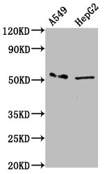 MFSD4 Antibody - Western Blot Positive WB detected in: A549 whole cell lysate, HepG2 whole cell lysate All Lanes: MFSD4A antibody at 3.38µg/ml Secondary Goat polyclonal to rabbit IgG at 1/50000 dilution Predicted band size: 57, 47 KDa Observed band size: 57 KDa