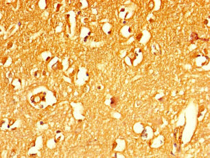 MFSD5 Antibody - Immunohistochemistry of paraffin-embedded human brain tissue using MFSD5 Antibody at dilution of 1:100