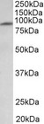 MFSD6 Antibody - MFSD6 antibody (1 ug/ml) staining of Human Heart lysate (35 ug protein in RIPA buffer). Primary incubation was 1 hour. Detected by chemiluminescence.