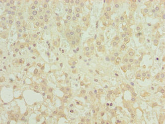 MFSD8 Antibody - Immunohistochemistry of paraffin-embedded human adrenal gland tissue using MFSD8 Antibody at dilution of 1:100